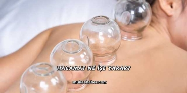 Hacamat Ne İşe Yarar?