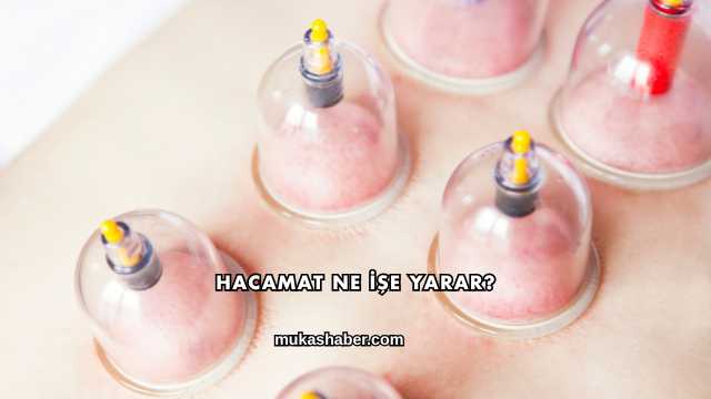 Hacamat Ne İşe Yarar?
