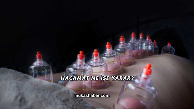 Hacamat Ne İşe Yarar?