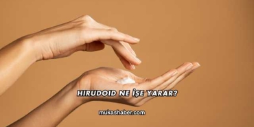 Hirudoid Ne İşe Yarar?