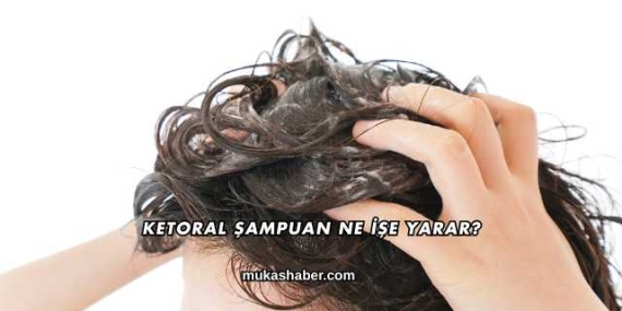 Ketoral Şampuan Ne İşe Yarar?