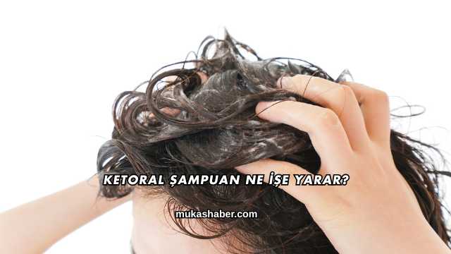 Ketoral Şampuan Ne İşe Yarar?