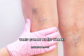 Varis Çorabı Ne İşe Yarar?