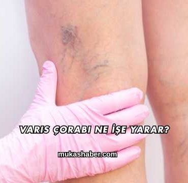 Varis Çorabı Ne İşe Yarar?