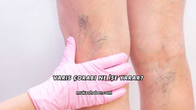 Varis Çorabı Ne İşe Yarar?