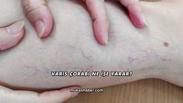 Varis Çorabı Ne İşe Yarar?